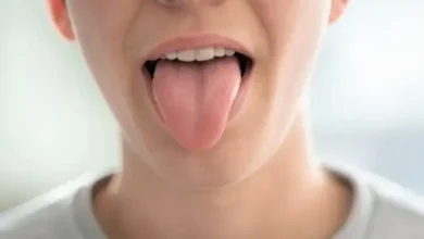 اعرف صحتك من لون لسانك