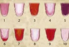 اعرف صحتك من لون لسانك دليل شامل لفهم إشارات الجسم