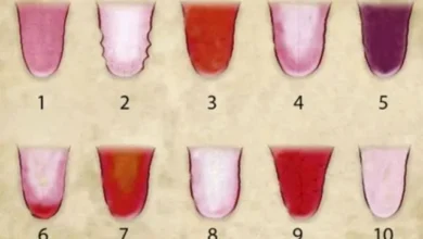 اعرف صحتك من لون لسانك دليل شامل لفهم إشارات الجسم