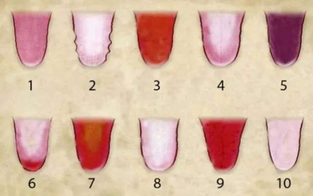 اعرف صحتك من لون لسانك دليل شامل لفهم إشارات الجسم